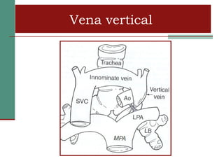 Vena vertical
 