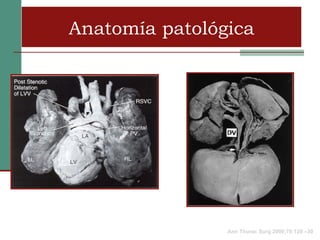 Anatomía patológica




                Ann Thorac Surg 2000;70:128 –30
 