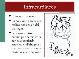 Infracardiacos
♥ El menos frecuente
♥ La conexión anómala se
  realiza por debajo del
  diafragma
♥ Se forma un tronco
  común por detrás de la
  aurícula izquierda
  atraviesa el diafragma y
  drena en sistema venoso
  portal o sus tributarias
 