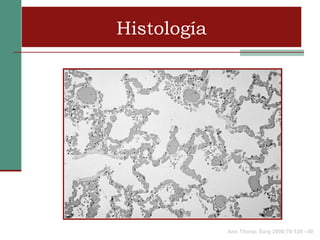 Histología




             Ann Thorac Surg 2000;70:128 –30
 