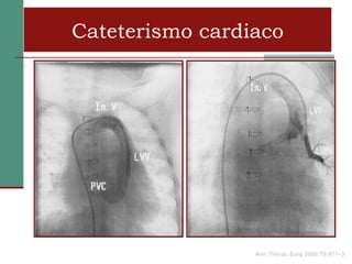 Cateterismo cardiaco




                 Ann Thorac Surg 2000;70:971–3
 