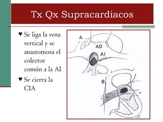 Tx Qx Supracardiacos
♥ Se liga la vena
  vertical y se
  anastomosa el
  colector
  común a la AI
♥ Se cierra la
  CIA
 