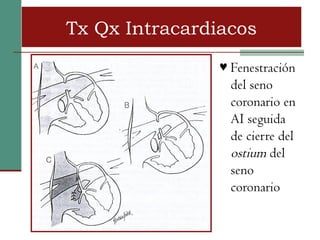 Tx Qx Intracardiacos
               ♥ Fenestración
                 del seno
                 coronario en
                 AI seguida
                 de cierre del
                 ostium del
                 seno
                 coronario
 
