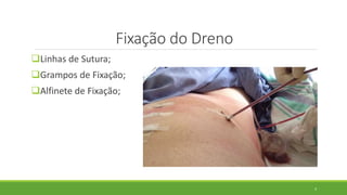Fixação do Dreno
Linhas de Sutura;
Grampos de Fixação;
Alfinete de Fixação;
4
 