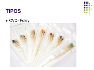 TIPOS
 CVD- Foley
 
