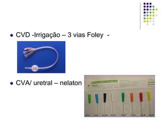  CVD -Irrigação – 3 vias Foley -
 CVA/ uretral – nelaton
 