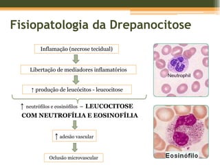 Fisiopatologia da Drepanocitose