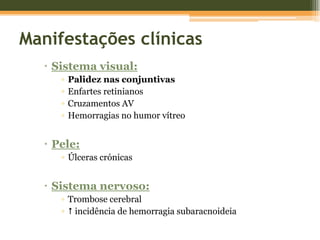 Actividade esplénica Susceptibilidade para infecções (especialmente Pneumococcus)PNEUMONIA (16 anos)Fig.16 – Raio X de tórax - pneumonia.