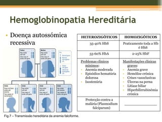 Hemoglobinopatia HereditáriaMutação braço curto do cromossoma 116ª posição cadeia β-globina substituição resíduo         de glutamato por valina                 HbSFig.8 – Localização genética das cadeias de HbA, HbA2 e HbFFig.9 – Substituição do glutamato pela valina.