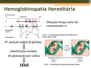 Falcemização – Como ocorre?Desoxigenação HbSInteracções hidrofóbicas com outras moléculas HbSAgregação em polímerosPolimerização em fibrilhas insolúveisDistorção da célula↓ deformabilidadeReversível com oxigenação