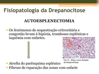  Taxa polimerização Hb