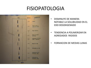 FISIOPATOLOGIA
        • DISMINUYE DE MANERA
          NOTABLE LA SOLUBILIDAD EN EL
          EDO DESOXIGENADO

        • TENDENCIA A POLIMERIZAR EN
          AGREGADOS RIGIDOS

        • FORMACION DE MEDIAS LUNAS
 