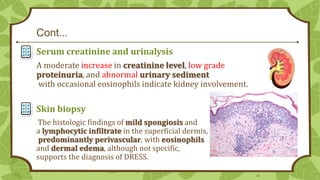 Cont...
Serum creatinine and urinalysis
A moderate increase in creatinine level, low grade
proteinuria, and abnormal urinary sediment
with occasional eosinophils indicate kidney involvement.

Skin biopsy
The histologic findings of mild spongiosis and
a lymphocytic infiltrate in the superficial dermis,
predominantly perivascular, with eosinophils
and dermal edema, although not specific,
supports the diagnosis of DRESS.
26

 