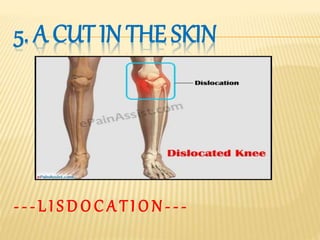 Dressing and bandages | PPT
