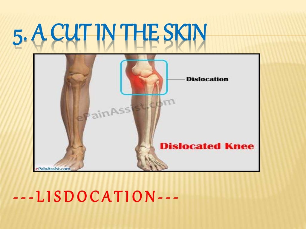 Dressing and bandages