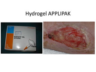 Hydrogel APPLIPAK
 