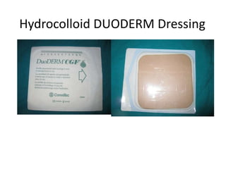 Hydrocolloid DUODERM Dressing
 