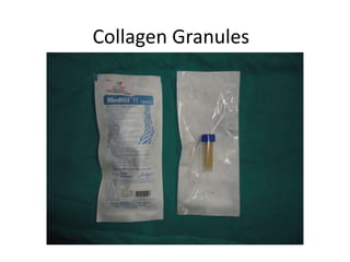 Collagen Granules
 
