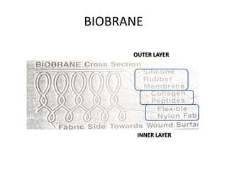 BIOBRANE
OUTER LAYER
INNER LAYER
 