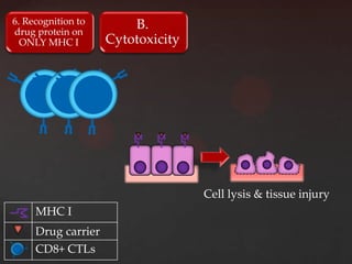 6. Recognition to       B.
drug protein on
  ONLY MHC I        Cytotoxicity




                                   Cell lysis & tissue injury
     MHC I
     Drug carrier
     CD8+ CTLs
 