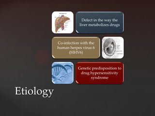 Defect in the way the
                       liver metabolizes drugs



           Co-infection with the
           human herpes virus 6
                 (HHV6)



                      Genetic predisposition to
                       drug hypersensitivity
                             syndrome



Etiology
 