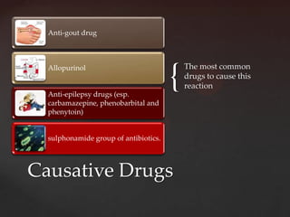 Anti-gout drug




                                       {
  Allopurinol                              The most common
                                           drugs to cause this
                                           reaction
  Anti-epilepsy drugs (esp.
  carbamazepine, phenobarbital and
  phenytoin)


  sulphonamide group of antibiotics.



Causative Drugs
 