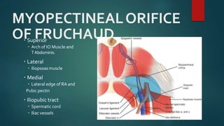MYOPECTINEALORIFICE
OF FRUCHAUD Superior
 Arch of IO Muscle and
TAbdominis.
 Lateral
 Iliopsoas muscle
 Medial
 Lateral edge of RA and
Pubic pectin
 Iliopubic tract
 Spermatic cord
 Iliac vessels
 