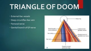 TRIANGLE OF DOOM
 External iliac vessels
 Deep circumflex iliac vein
 Femoral nerve
 Genital branch ofGFnerve
 