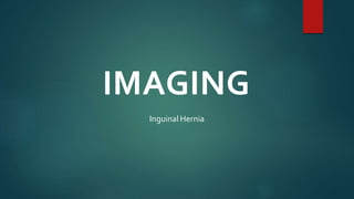IMAGING
Inguinal Hernia
 