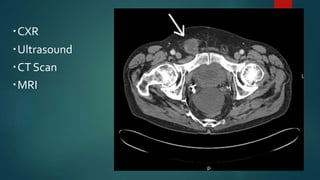 CXR
Ultrasound
CTScan
MRI
 