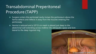 Transabdominal Preperitoneal
Procedure (TAPP)
 Surgeon enters the peritoneal cavity incises the peritoneum above the
hernia defects and reflects it away from the muscles entering Pre-
peritonealy
 Hernia is reduced and a 10*15 cm mesh is placed just deep to the
abdominal wall extending across midline into retropubic space and 5cm
lateral to the deep inguinal ring.
 