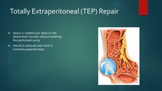 Totally Extraperitoneal (TEP) Repair
 Space is created just deep to the
abdominal msucles without entering
the peritoneal cavity
 Hernia is reduced and mesh is
inserted preperitonealy.
 