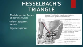 HESSELBACH’S
TRIANGLE
 Medial aspect of Rectus
abdominis muscle
 Inferior epigastric
vessels
 Inguinal ligament
 