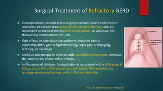 Kids Retching GERD, Dr Falakha .pptx