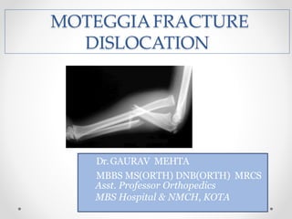 MOTEGGIAFRACTURE
DISLOCATION
Dr.GAURAV MEHTA
MBBS MS(ORTH) DNB(ORTH) MRCS
Asst. Professor Orthopedics
MBS Hospital & NMCH, KOTA
 