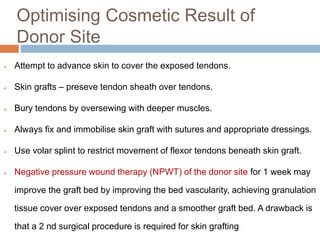 Optimising Cosmetic Result of
Donor Site
 Attempt to advance skin to cover the exposed tendons.
 Skin grafts – preseve tendon sheath over tendons.
 Bury tendons by oversewing with deeper muscles.
 Always fix and immobilise skin graft with sutures and appropriate dressings.
 Use volar splint to restrict movement of flexor tendons beneath skin graft.
 Negative pressure wound therapy (NPWT) of the donor site for 1 week may
improve the graft bed by improving the bed vascularity, achieving granulation
tissue cover over exposed tendons and a smoother graft bed. A drawback is
that a 2 nd surgical procedure is required for skin grafting
 