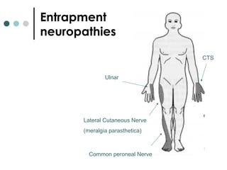 Entrapment
neuropathies
CTS
Ulnar
Lateral Cutaneous Nerve
(meralgia parasthetica)
Common peroneal Nerve
 