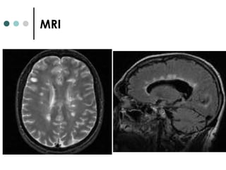 MRI
 
