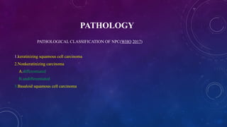 Npc Pathology Classification Understanding Nasopharyngeal Carcinoma: Risk Factors, Pathogenesis, and ...