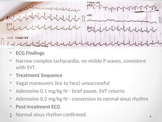 dr haider ali 2.ppt on svt and case study | PPT