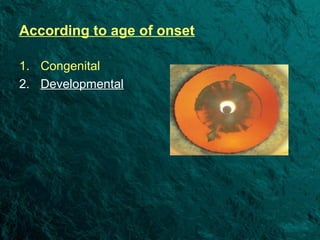Congenital cataract | PPT