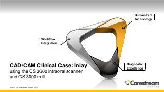 Workflow
Integration
Humanized
Technology
Diagnostic
Excellence
CAD/CAM Clinical Case: Inlay
using the CS 3600 intraoral scanner
and CS 3000 mill
Public. © Carestream Health, 2016
 