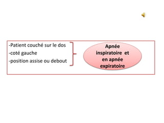 -Patient couché sur le dos
-coté gauche
-position assise ou debout
Apnée
inspiratoire et
en apnée
expiratoire
 