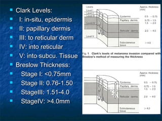 Head and Neck Melanoma | PPT