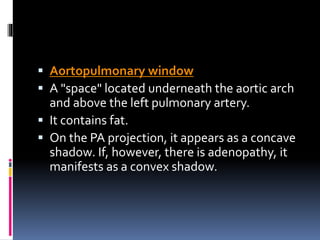 Aortic Shadow Basics of Chest X-Ray | PPTX