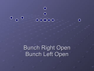 Bunch Right Open Bunch Left Open 