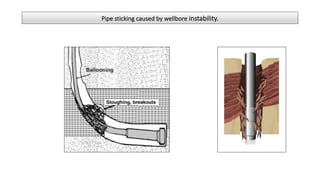 Pipe sticking caused by wellbore instability.
 