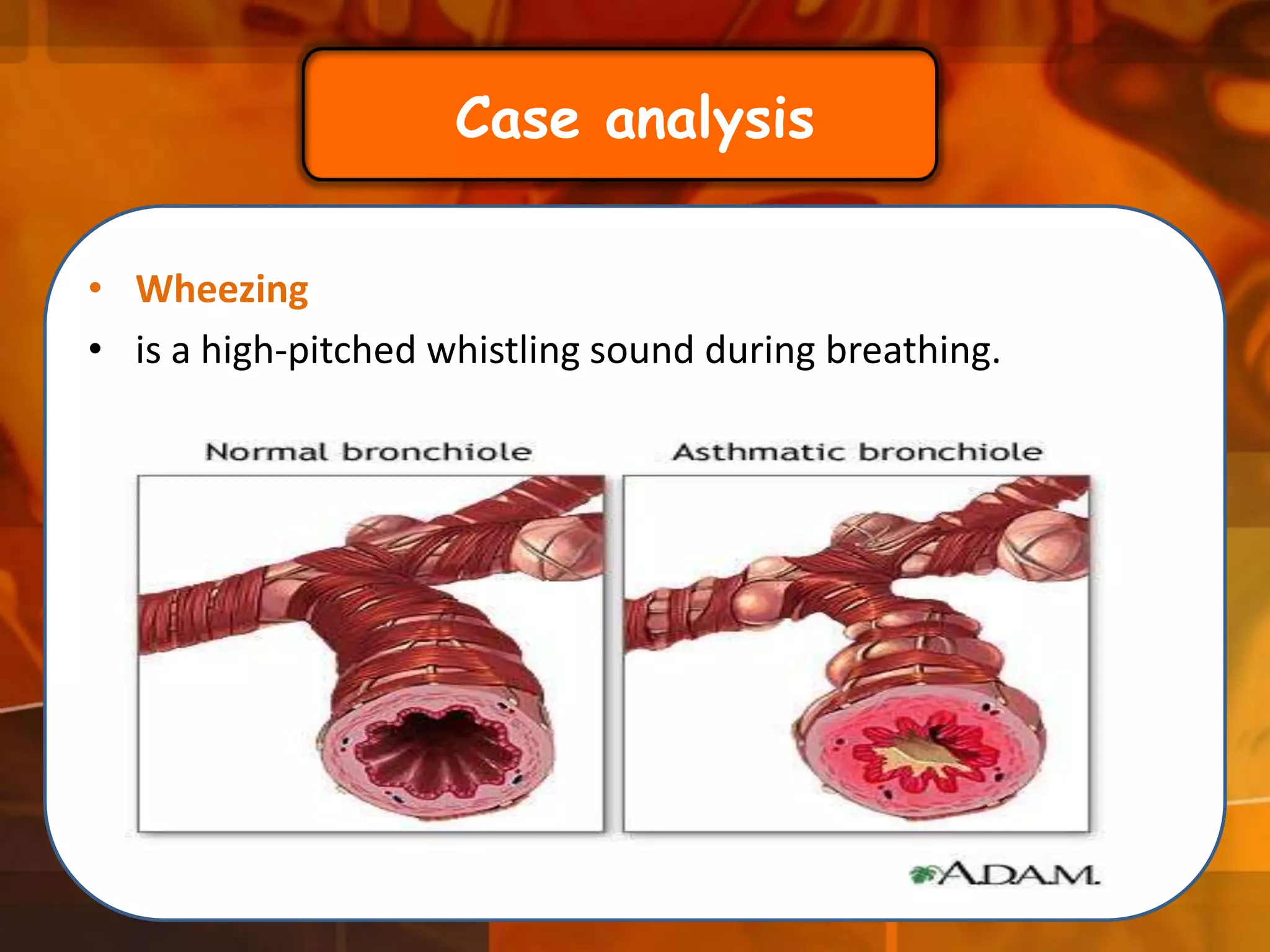 Case analysis
• Wheezing
• is a high-pitched whistling sound during breathing.

 