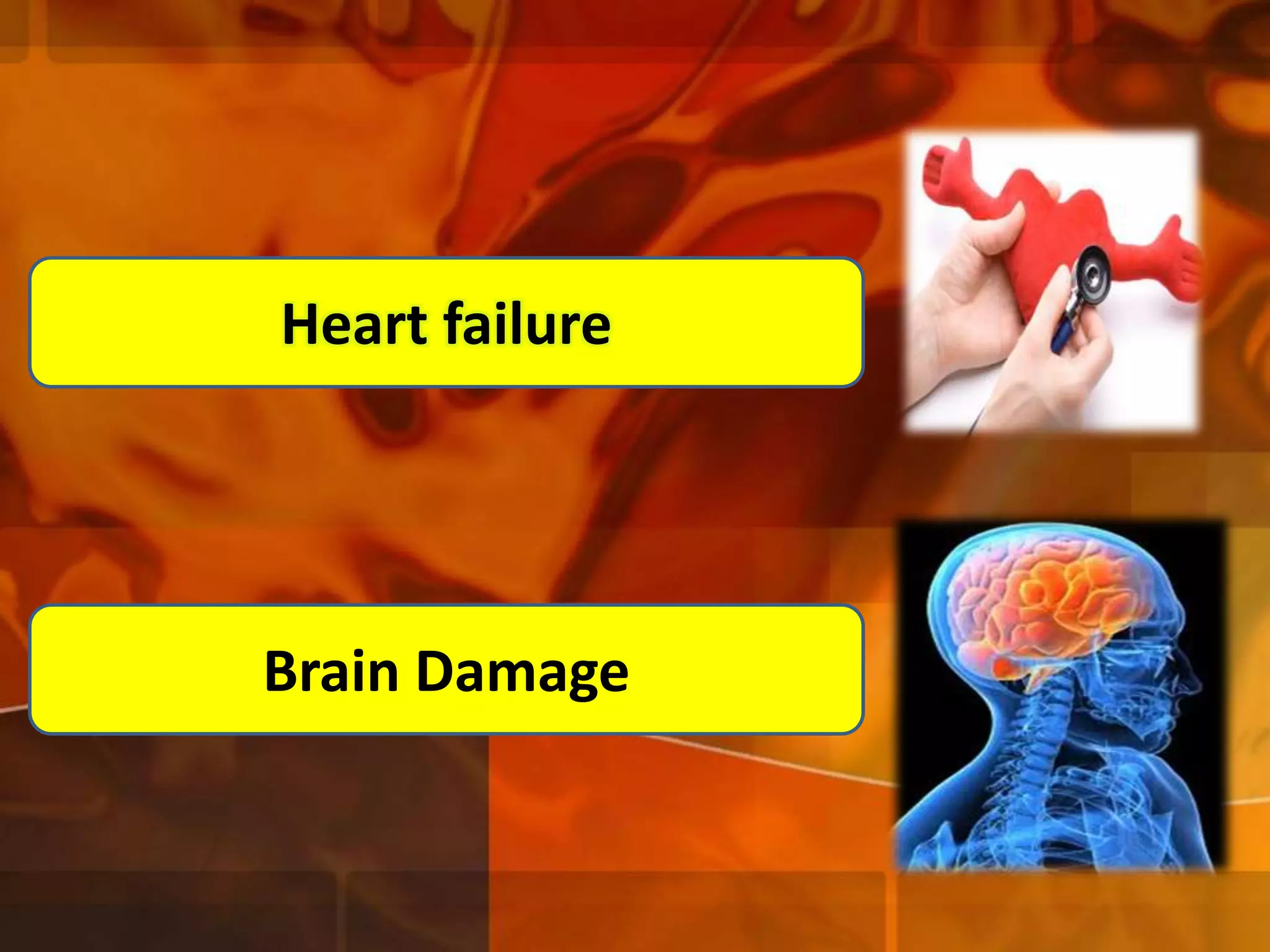 Heart failure

Brain Damage

 