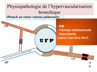 - RM
- Fibrose médiastinale
- Vascularite
Lésion barrière AlvC
 